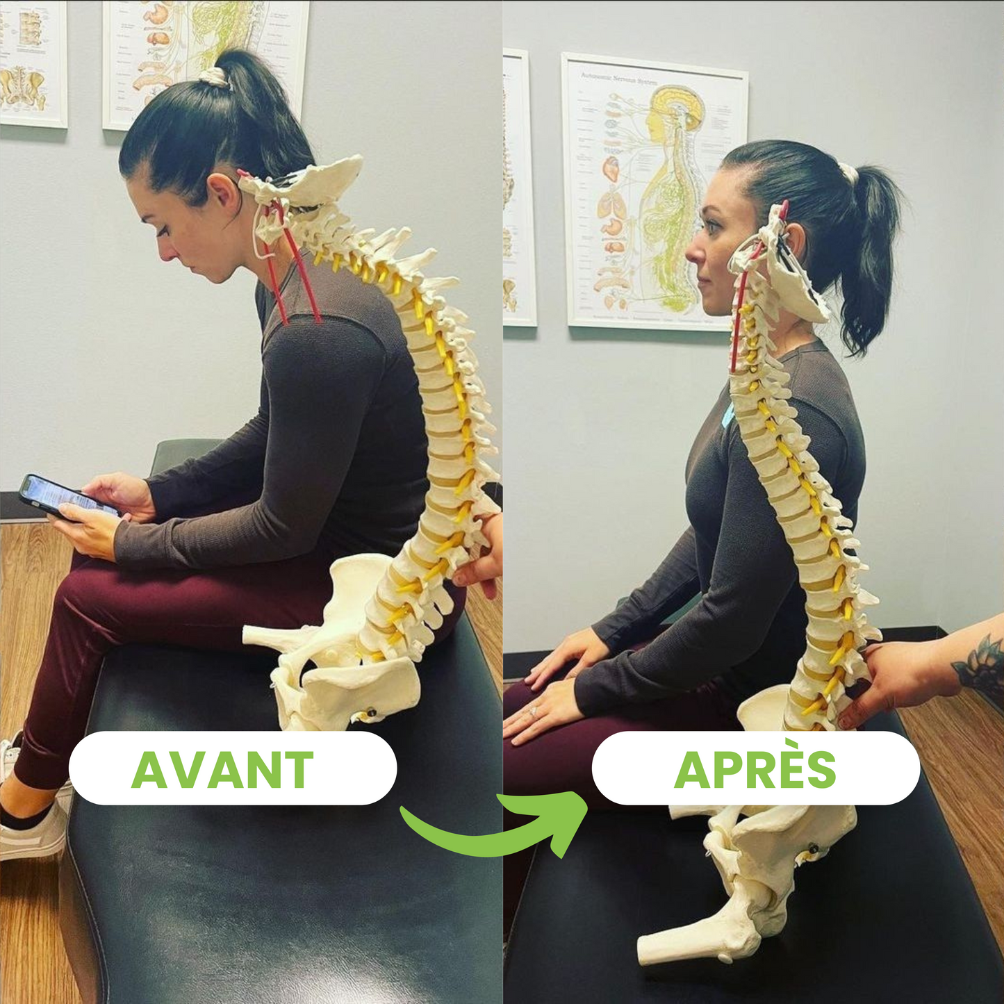 Correcteur de Posture SpineCare™